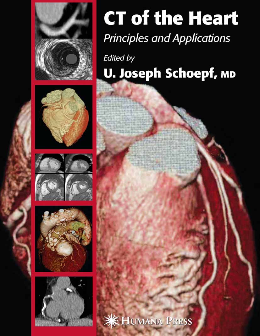 Cover CT of the Heart