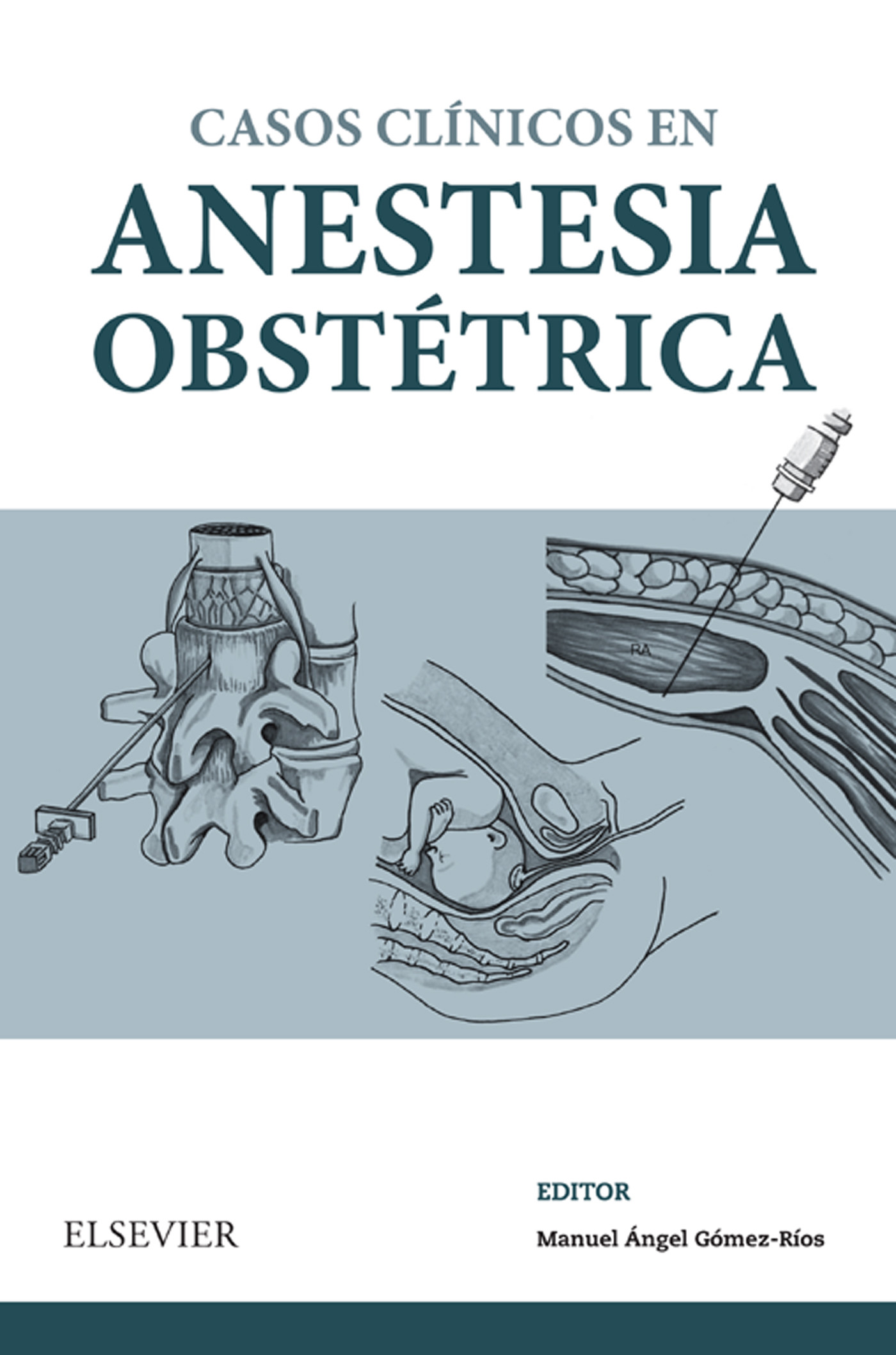 Cover Casos Clínicos en anestesia obstétrica