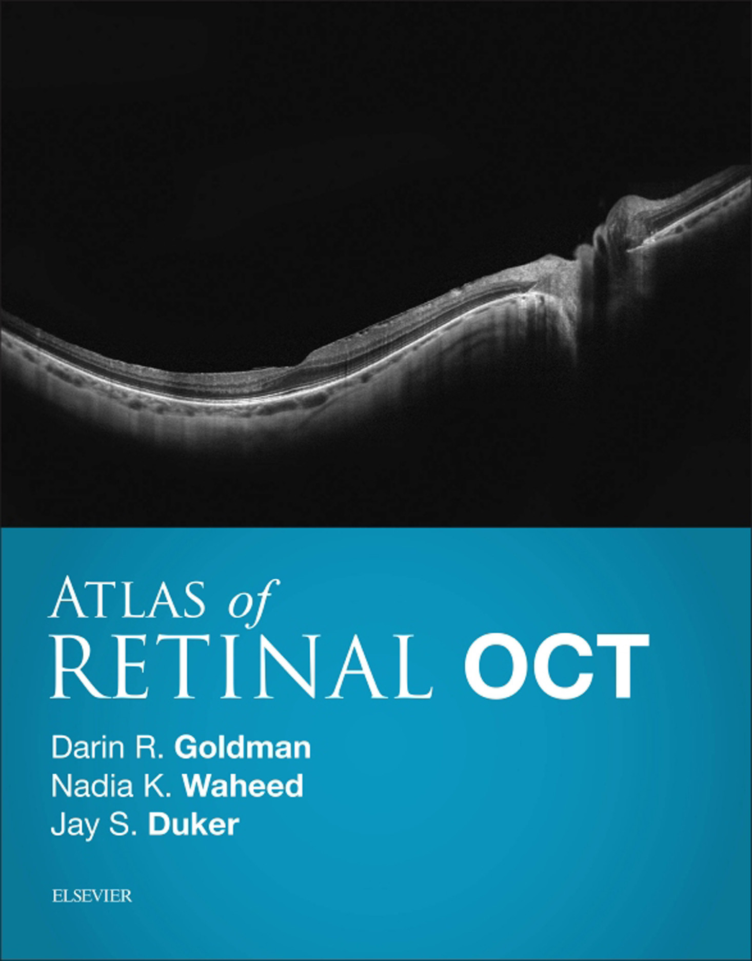 Cover Atlas of Retinal OCT E-Book