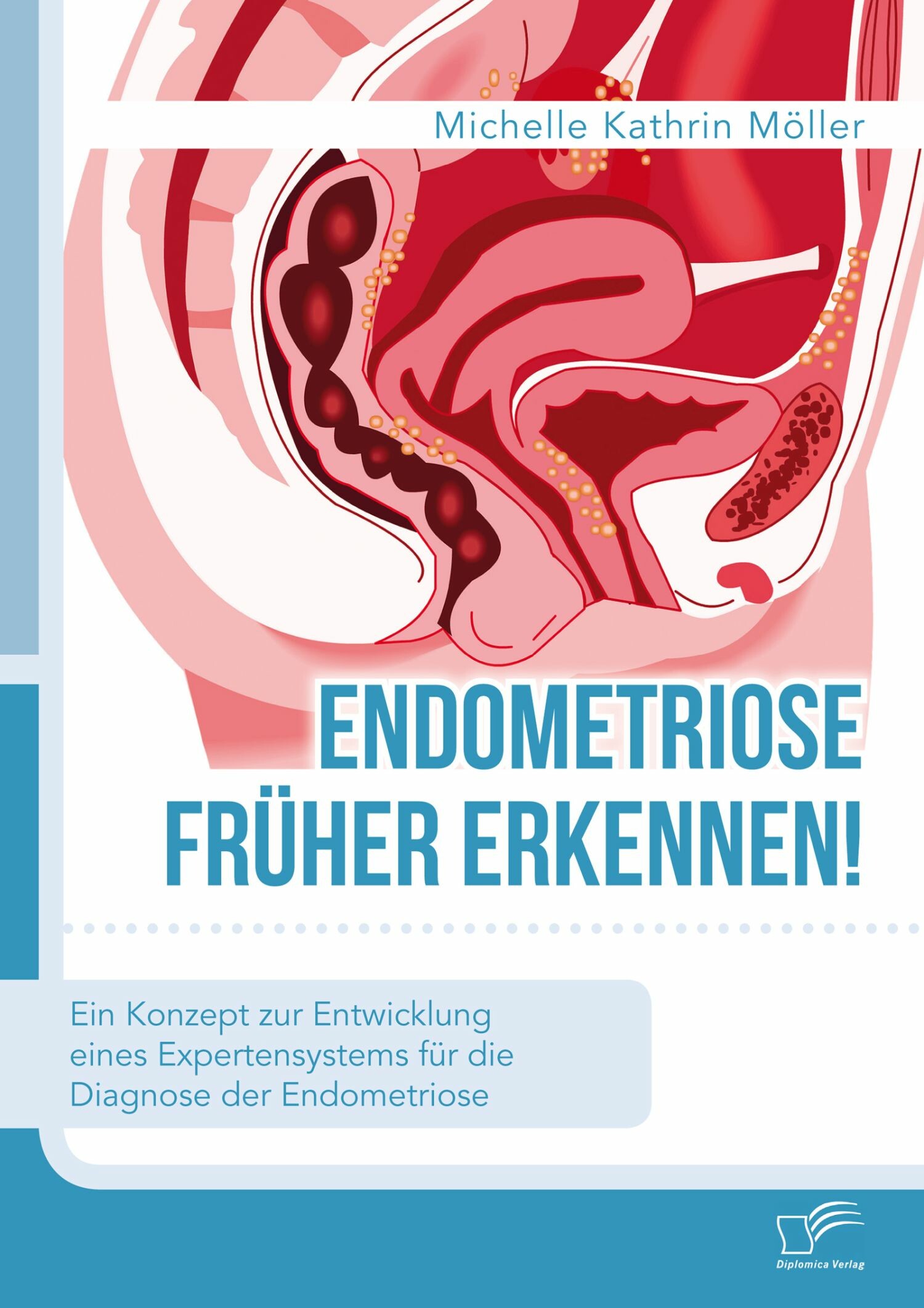 Endometriose früher erkennen! Ein Konzept zur Entwicklung eines Expertensystems für die Diagnose der Endometriose