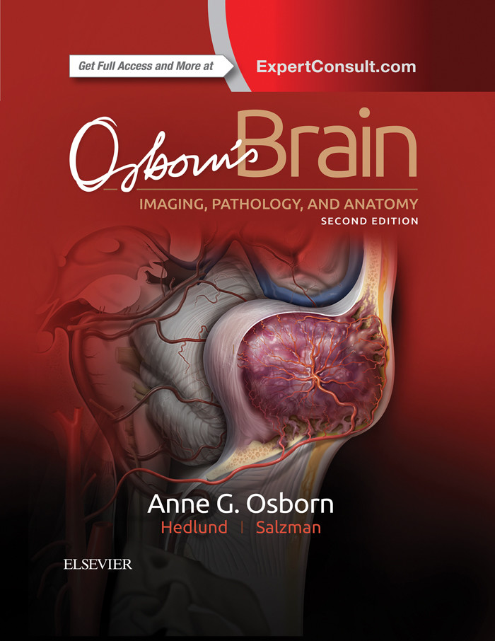 Osborn's Brain E-Book
