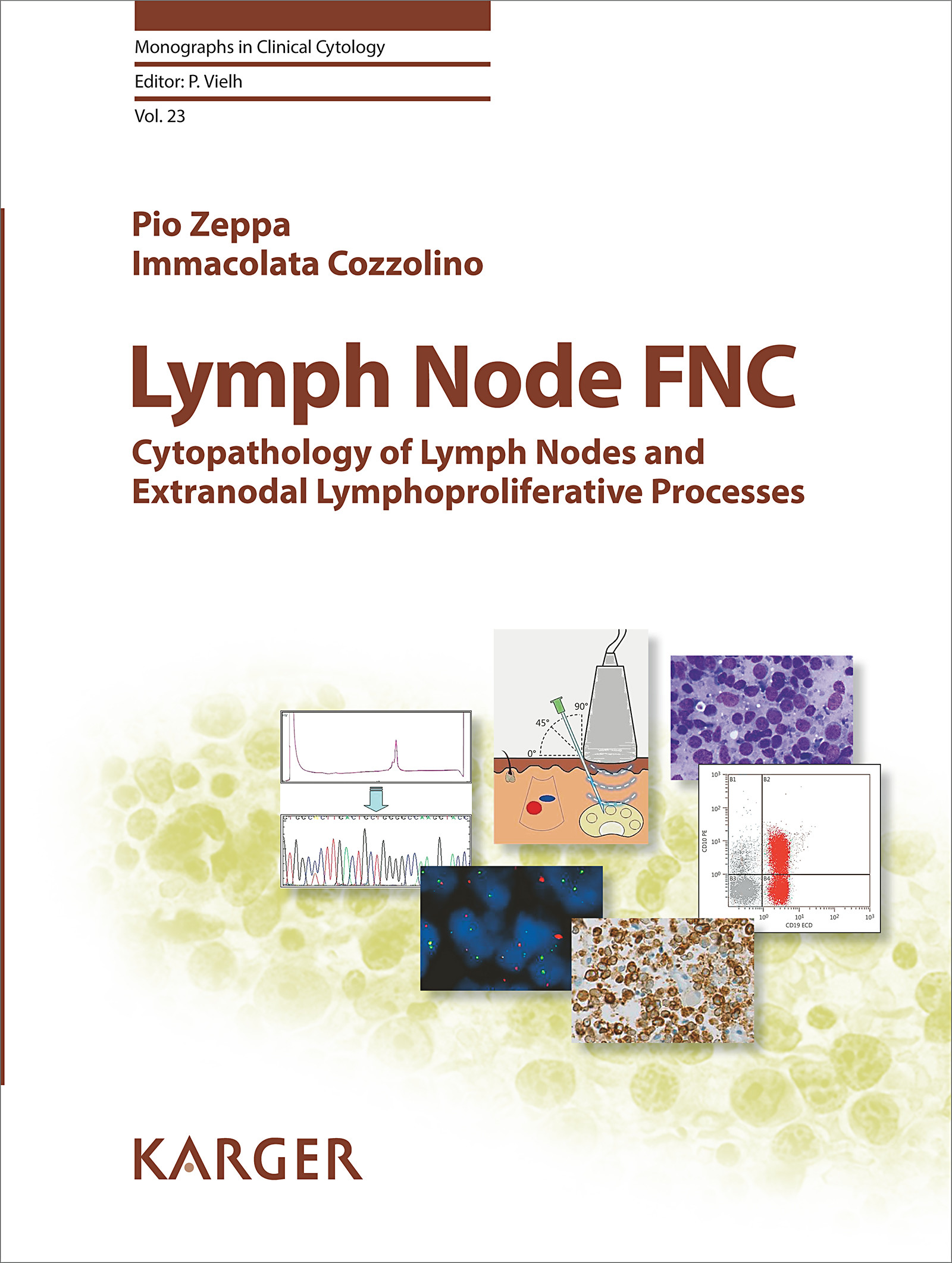 Cover Lymph Node FNC