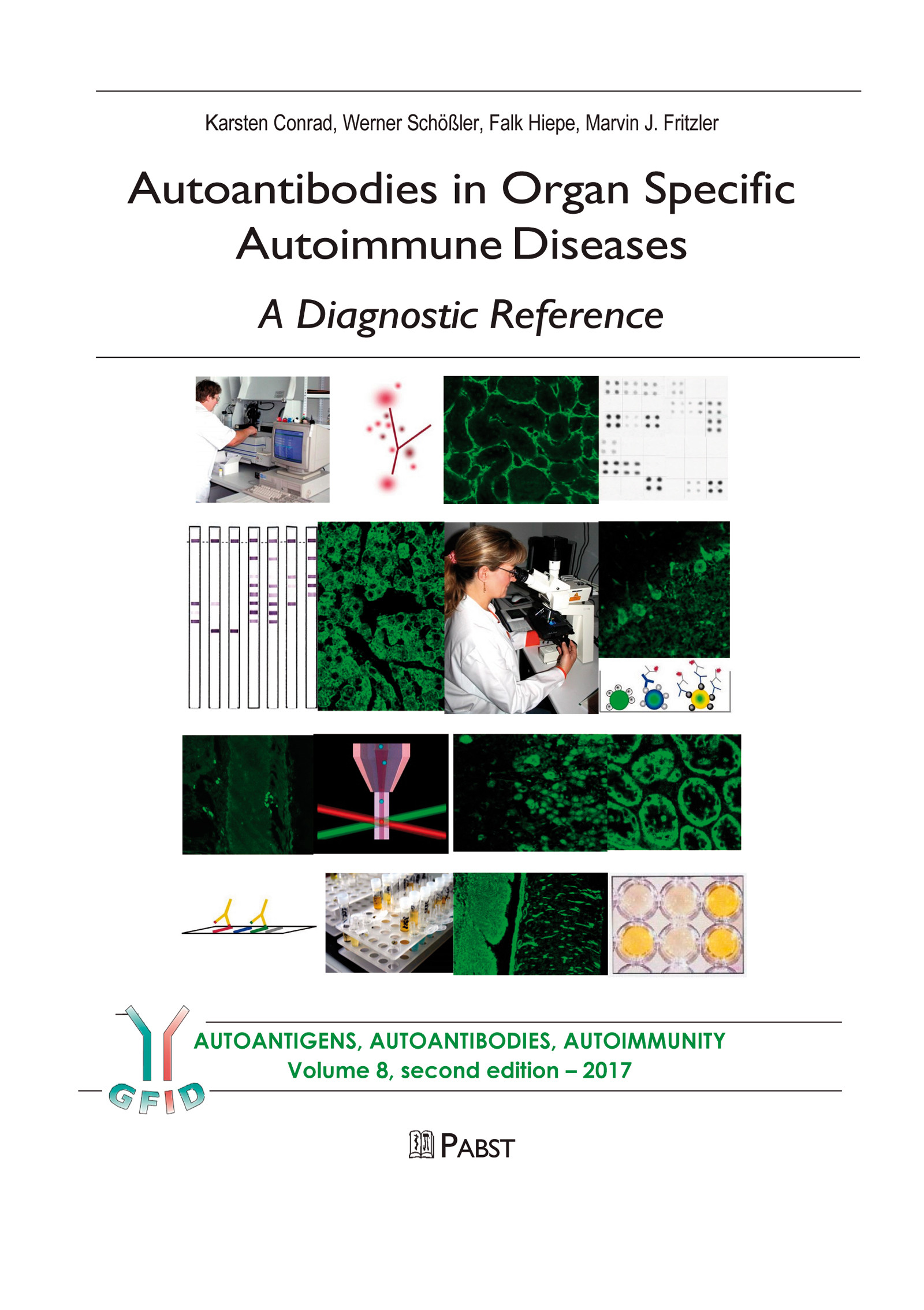 Cover Autoantibodies in Organ Specific Autoimmune Diseases – A Diagnostic Reference