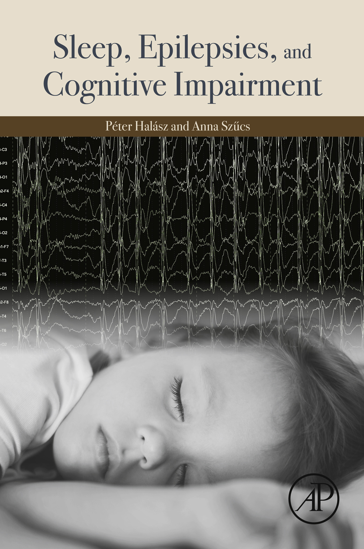 Cover Sleep, Epilepsies, and Cognitive Impairment