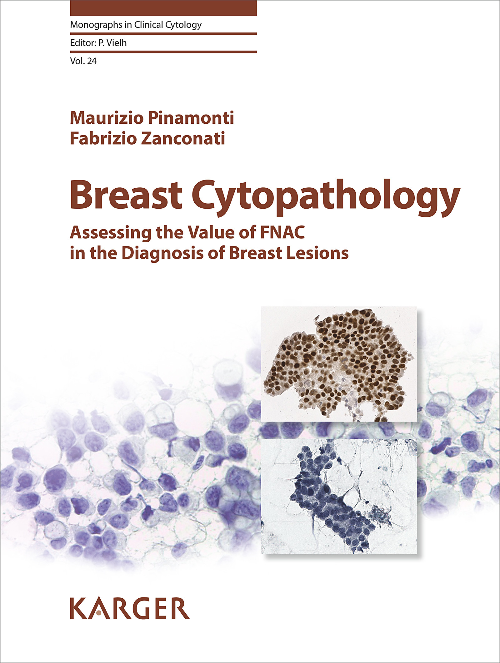 Cover Breast Cytopathology