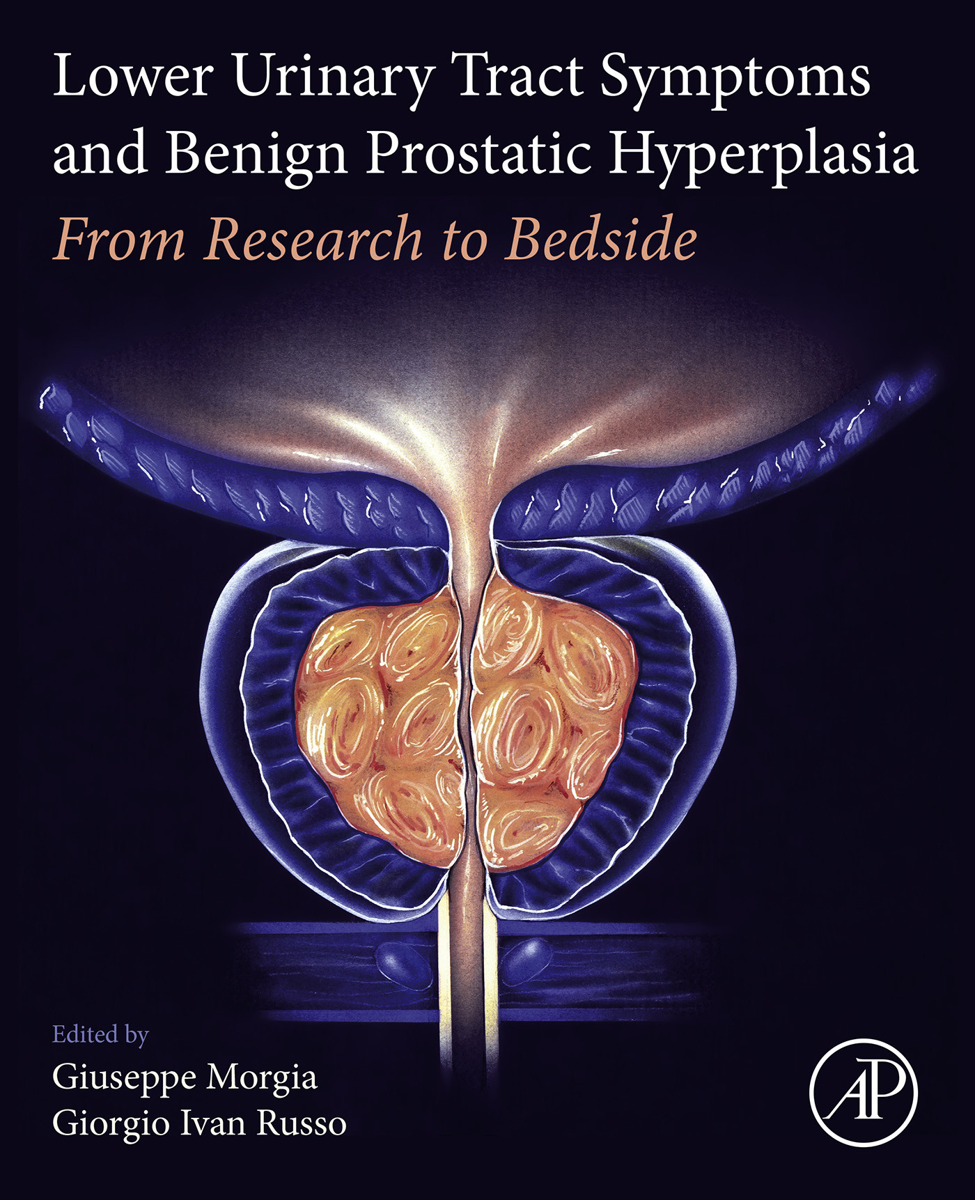 Cover Lower Urinary Tract Symptoms and Benign Prostatic Hyperplasia