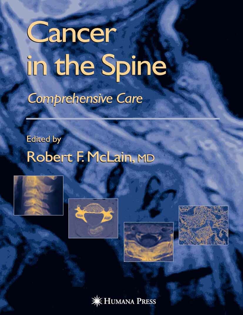 Cancer in the Spine