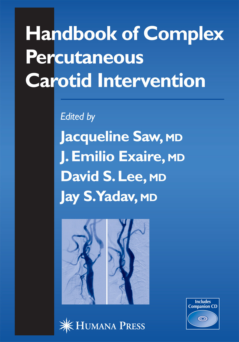 Cover Handbook of Complex Percutaneous Carotid Intervention