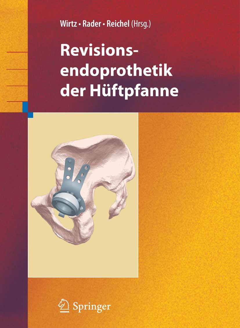 Cover Revisionsendoprothetik der Hüftpfanne