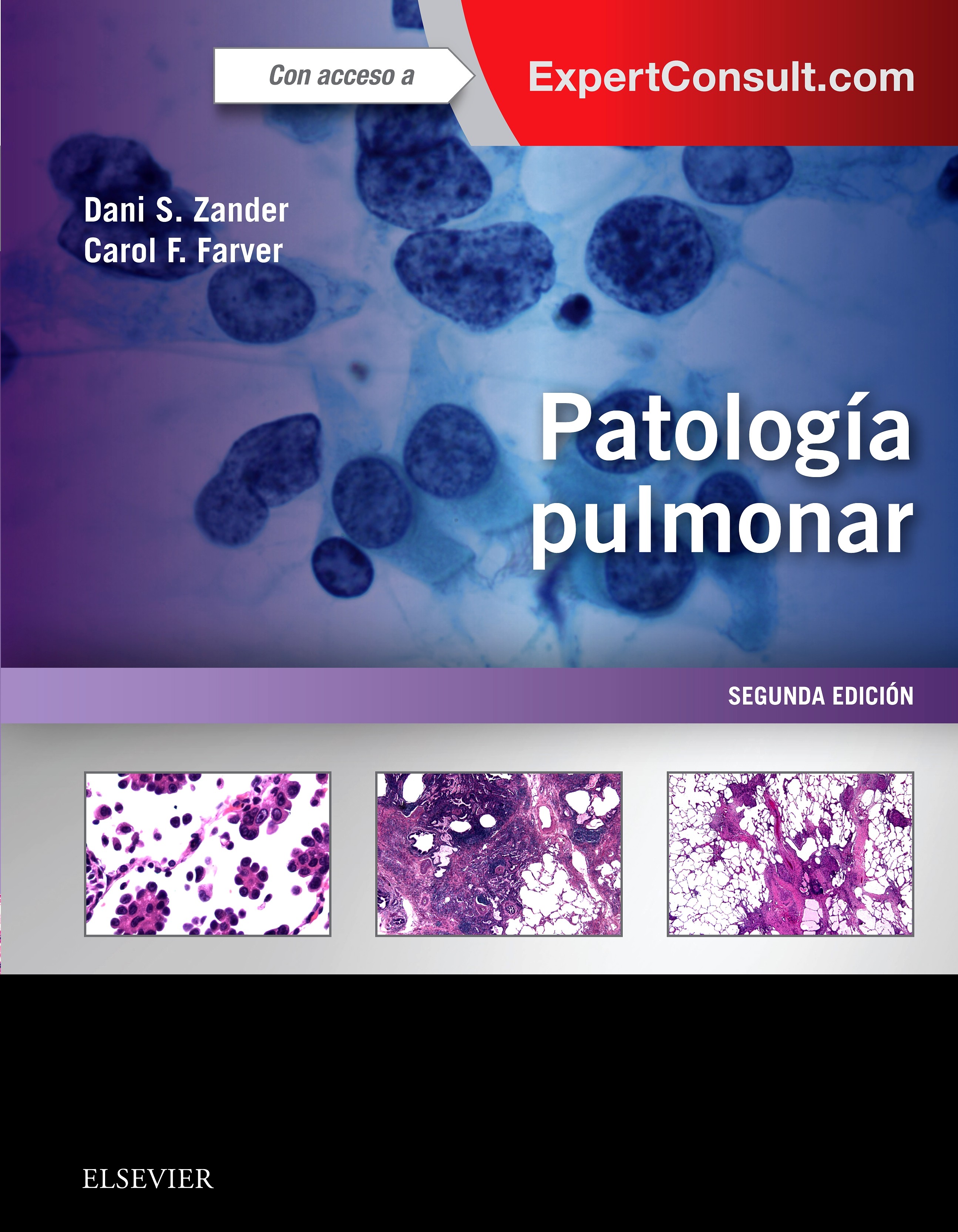Cover Patología pulmonar + ExpertConsult