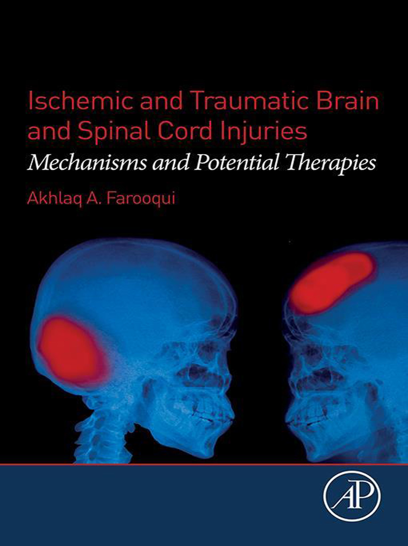 Cover Ischemic and Traumatic Brain and Spinal Cord Injuries