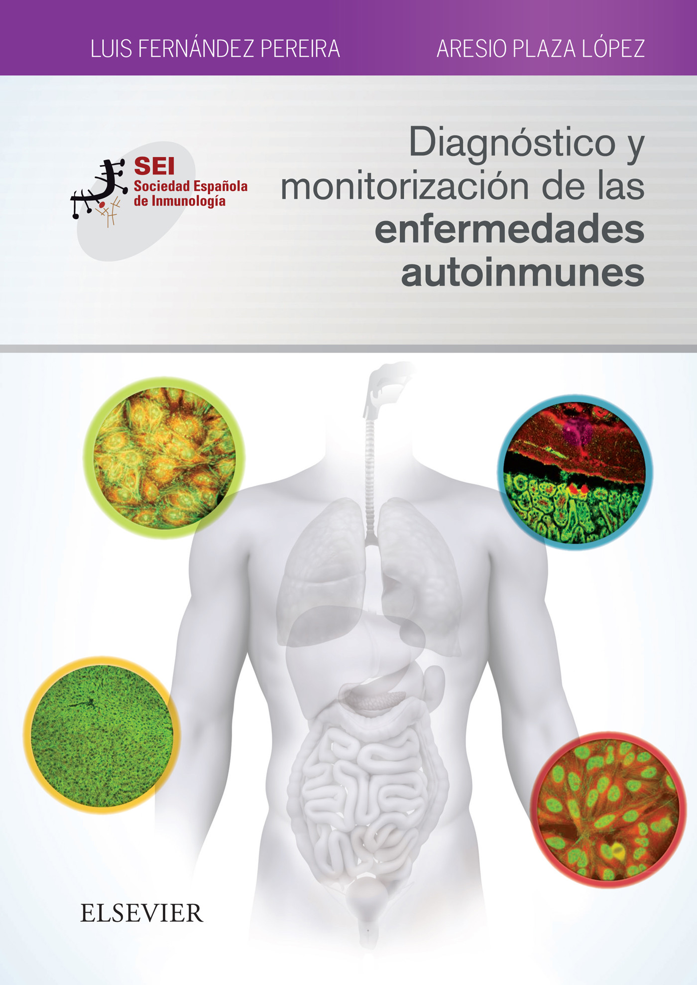 Cover Diagnóstico y monitorización de las enfermedades autoinmunes