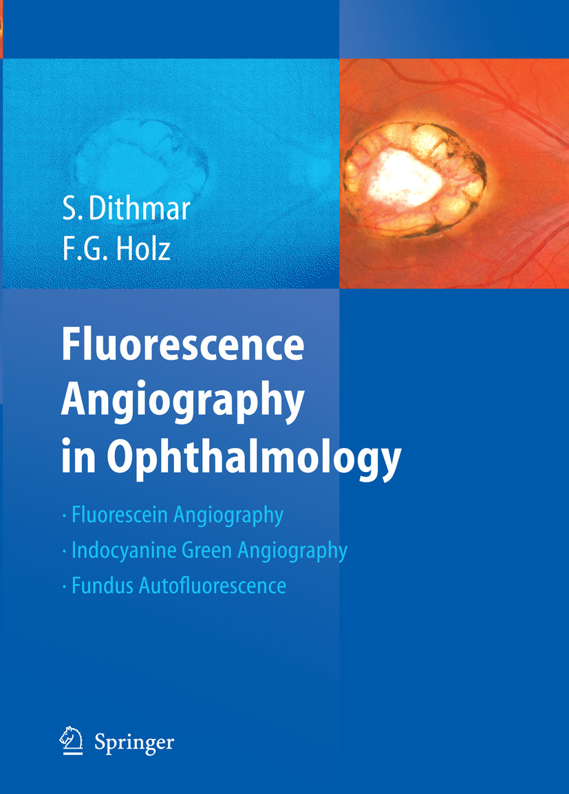 Cover Fluorescence Angiography in Ophthalmology