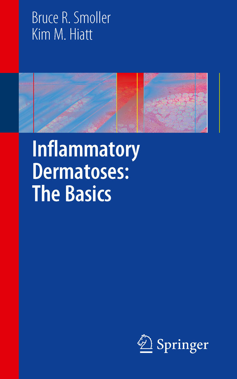 Cover Inflammatory Dermatoses: The Basics