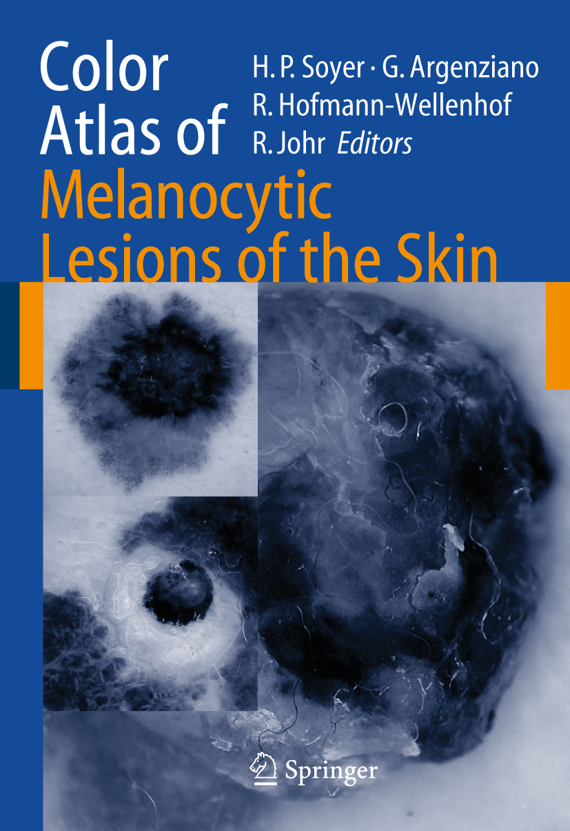 Cover Color Atlas of Melanocytic Lesions of the Skin