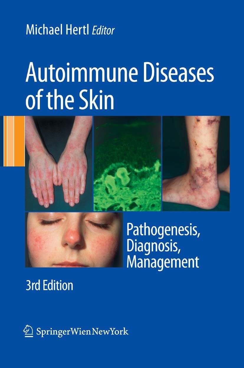Cover Autoimmune Diseases of the Skin