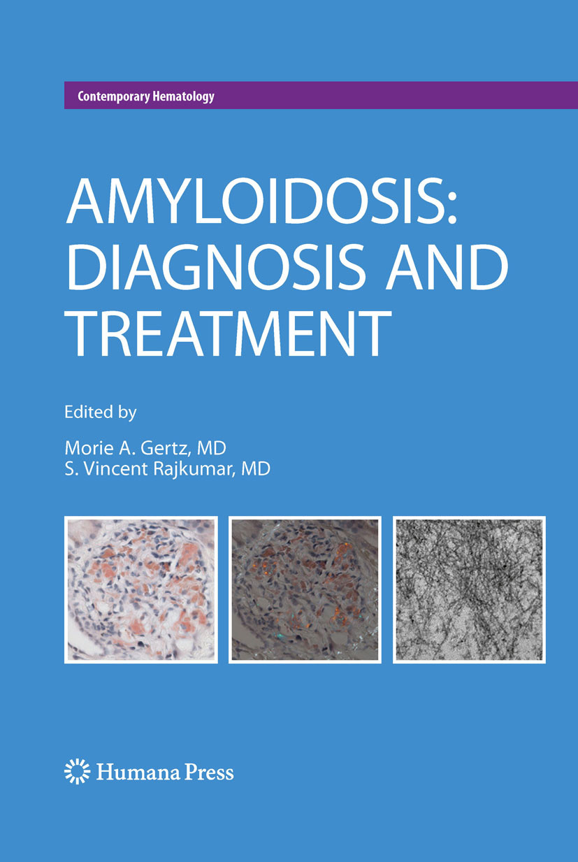 Cover Amyloidosis