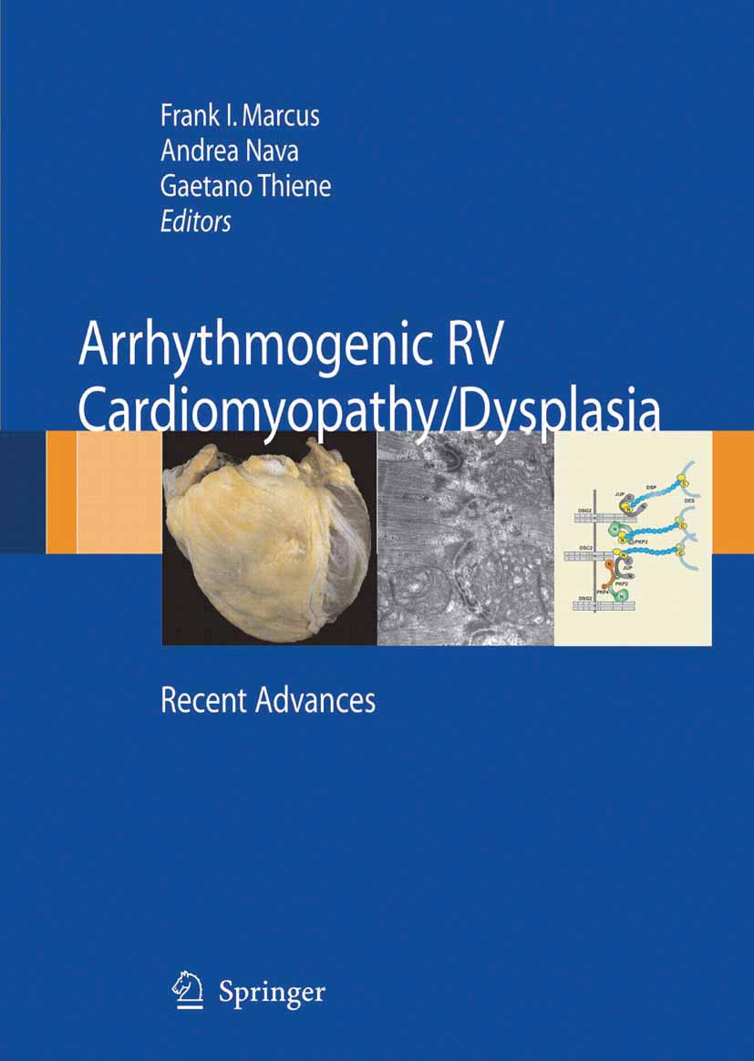 Cover Arrhythmogenic RV Cardiomyopathy/Dysplasia