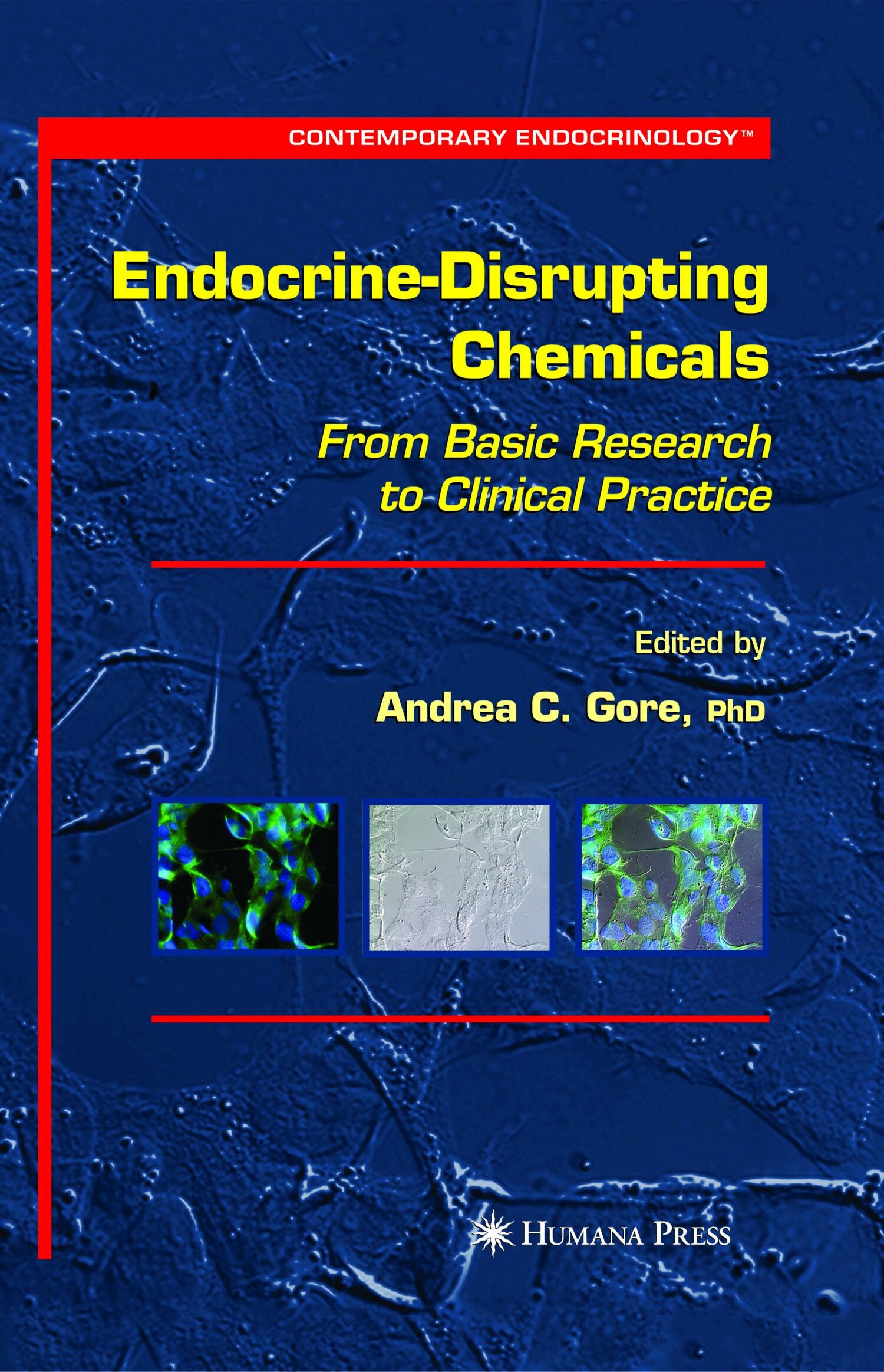 Endocrine-Disrupting Chemicals