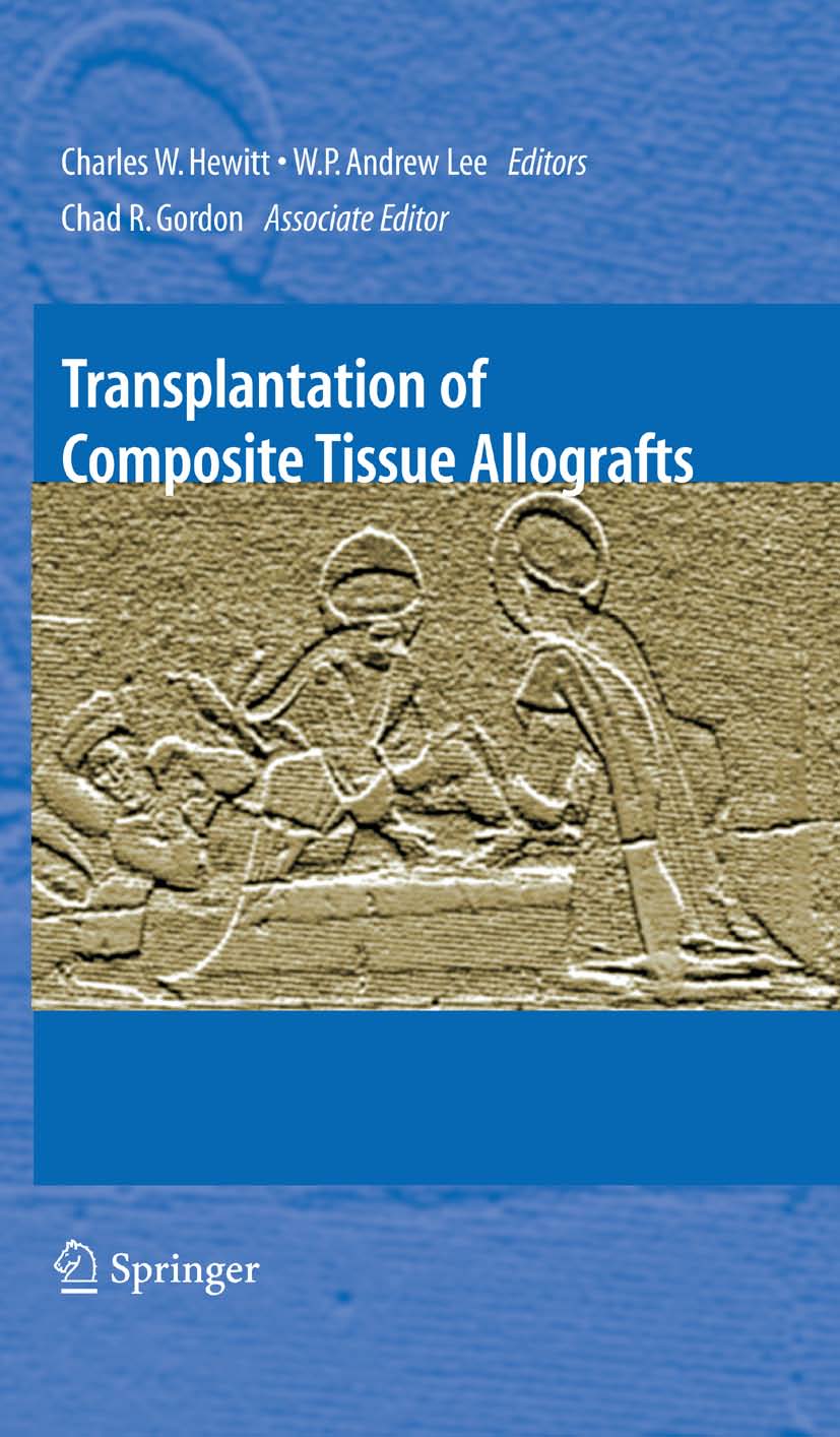 Cover Transplantation of Composite Tissue Allografts