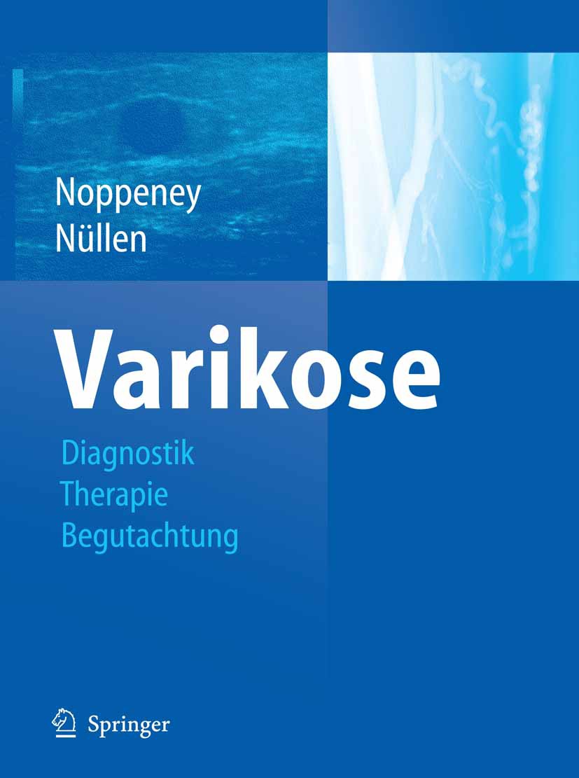 Cover Varikose
