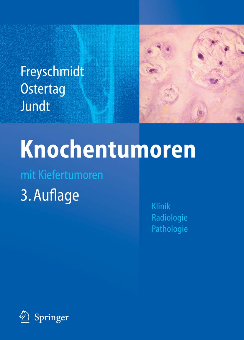 Cover Knochentumoren mit Kiefertumoren