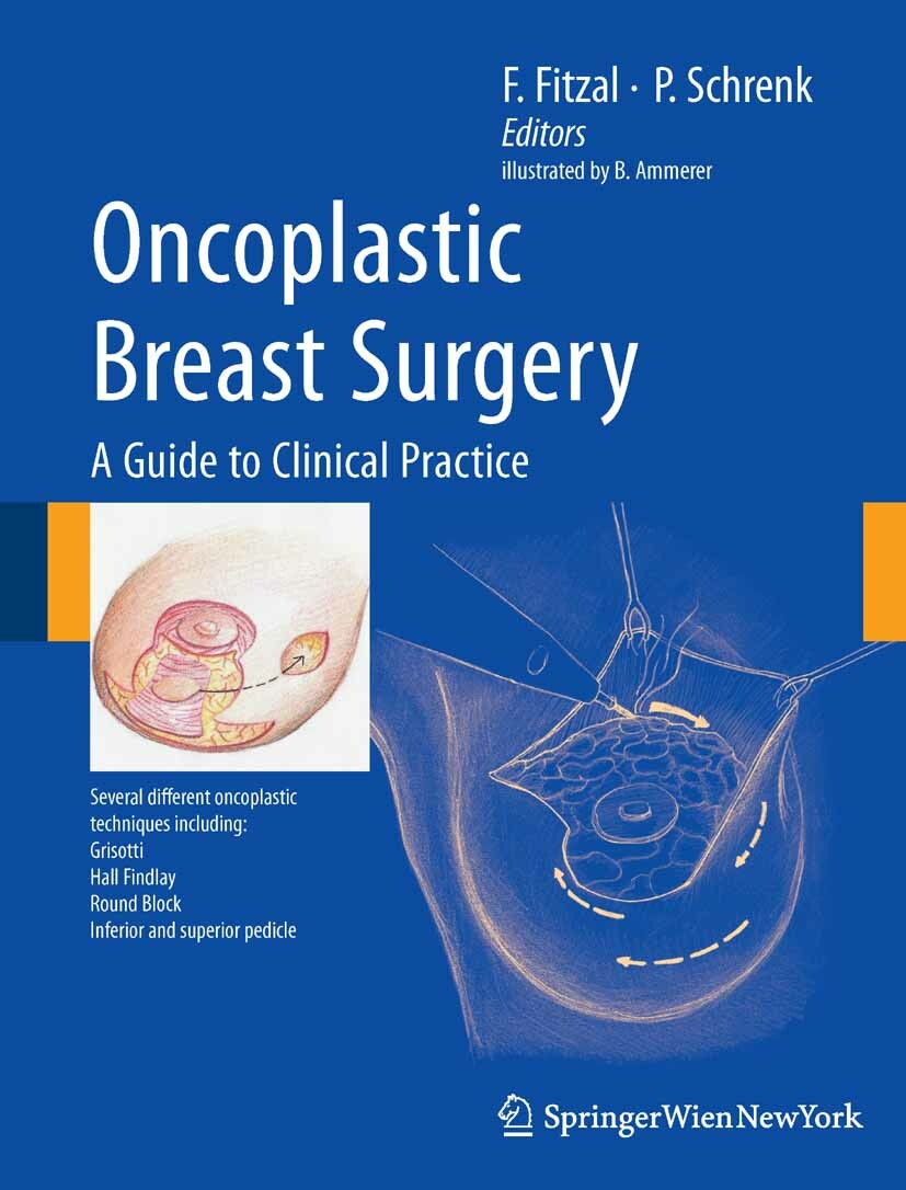 Cover Oncoplastic Breast Surgery