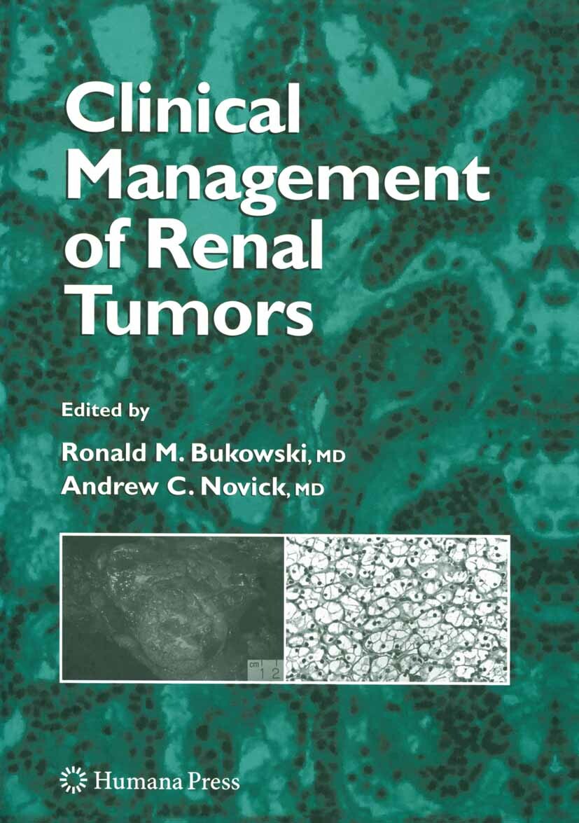 Cover Clinical Management of Renal Tumors