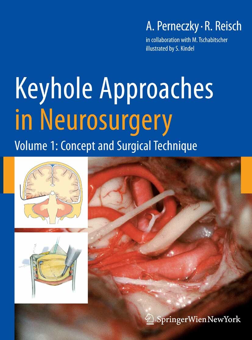 Cover Keyhole Approaches in Neurosurgery