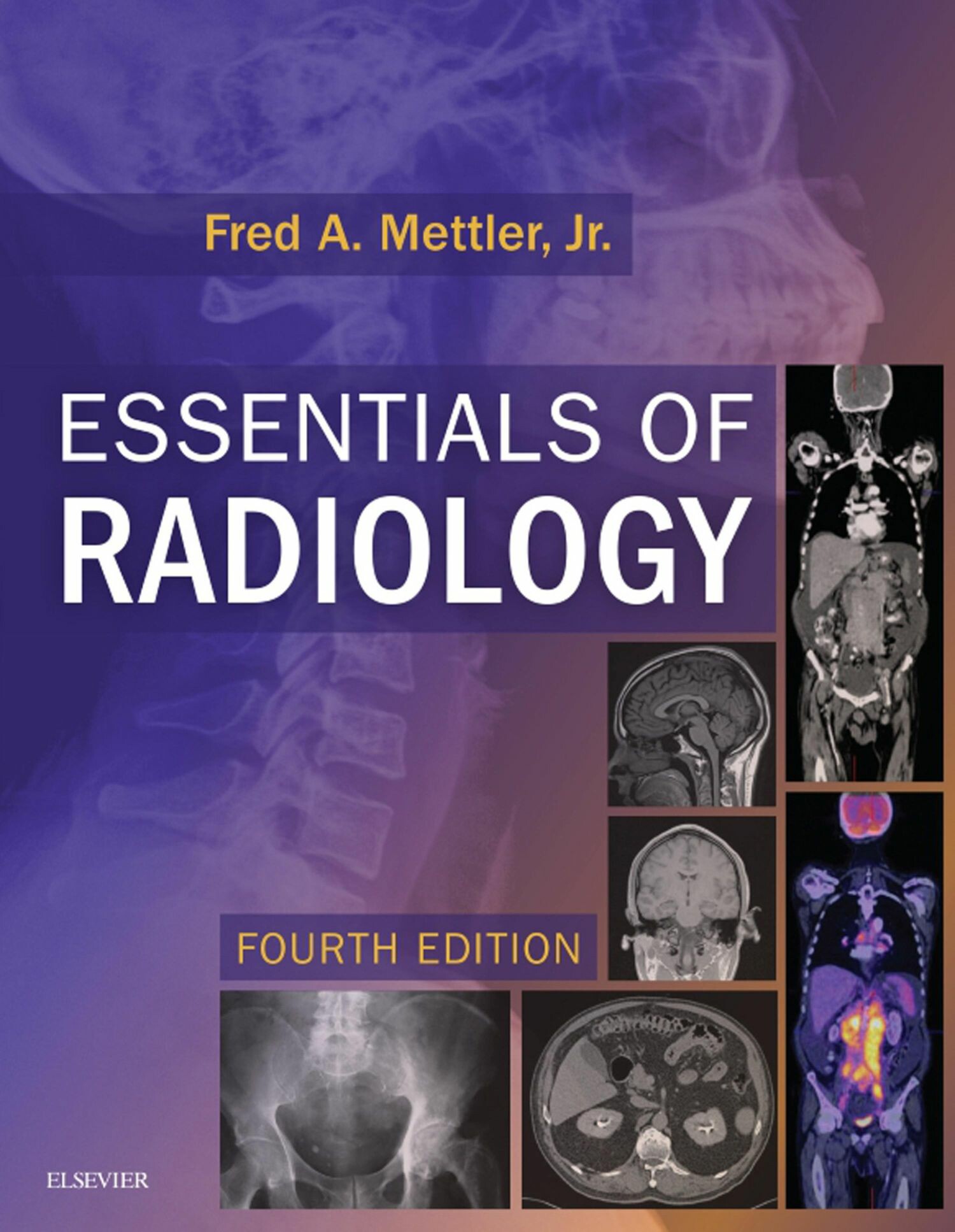 Cover Essentials of Radiology E-Book