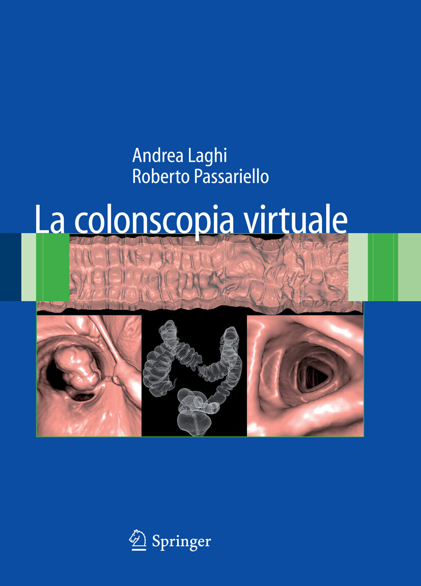 Cover La colonscopia virtuale