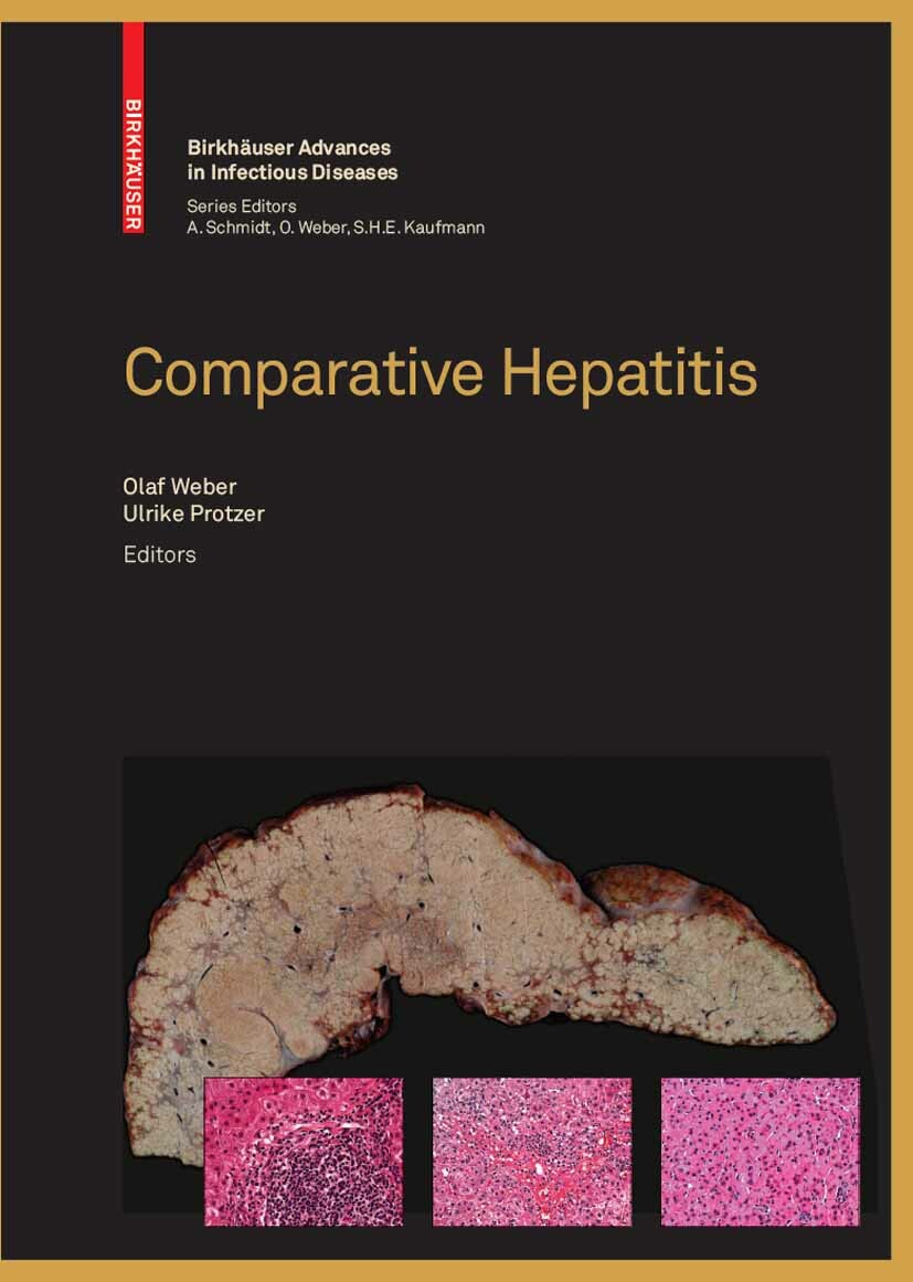Cover Comparative Hepatitis