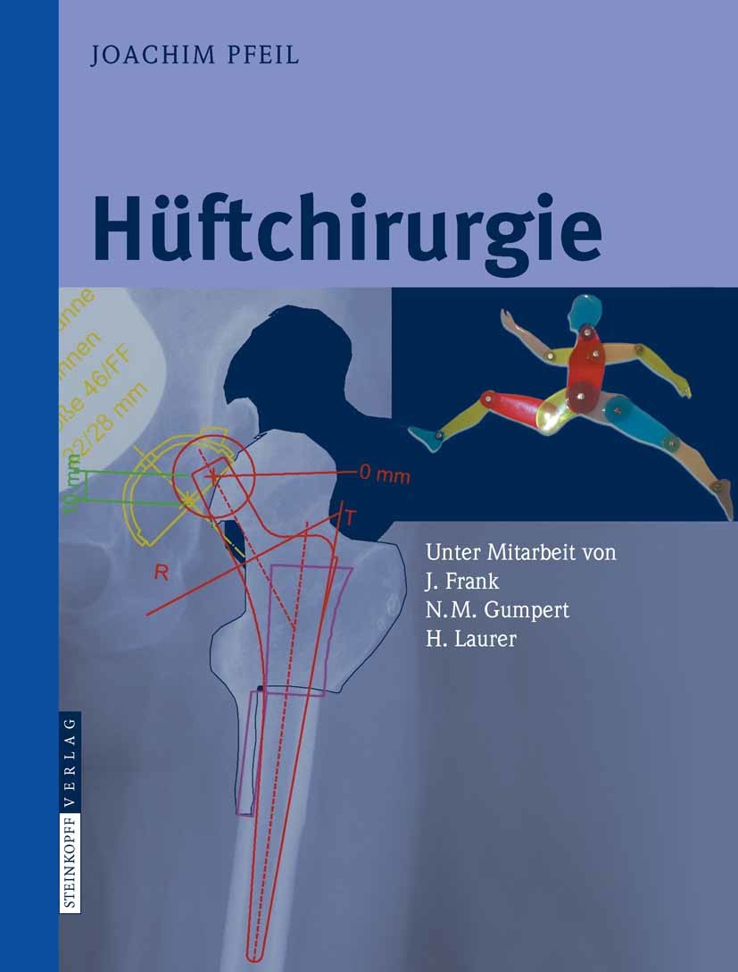 Cover Hüftchirurgie