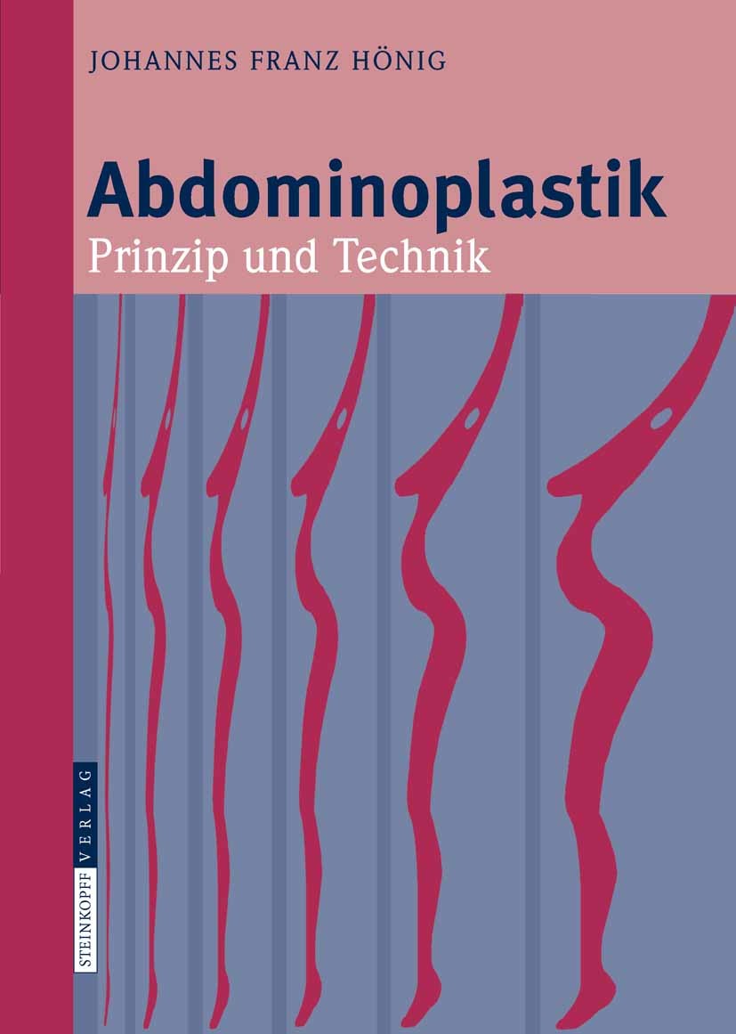 Cover Abdominoplastik