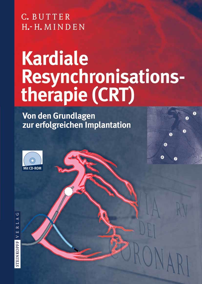 Kardiale Resynchronisationstherapie (CRT)