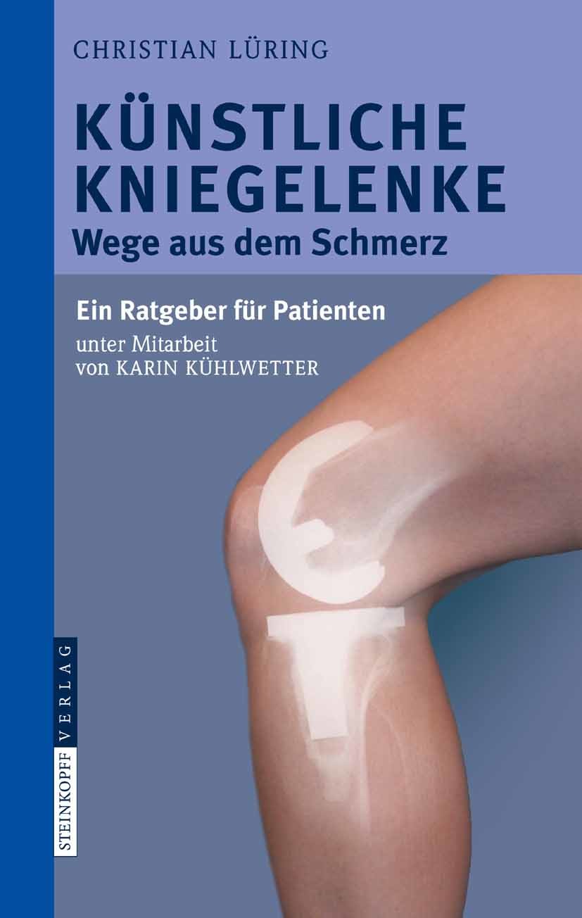 Cover Künstliche Kniegelenke