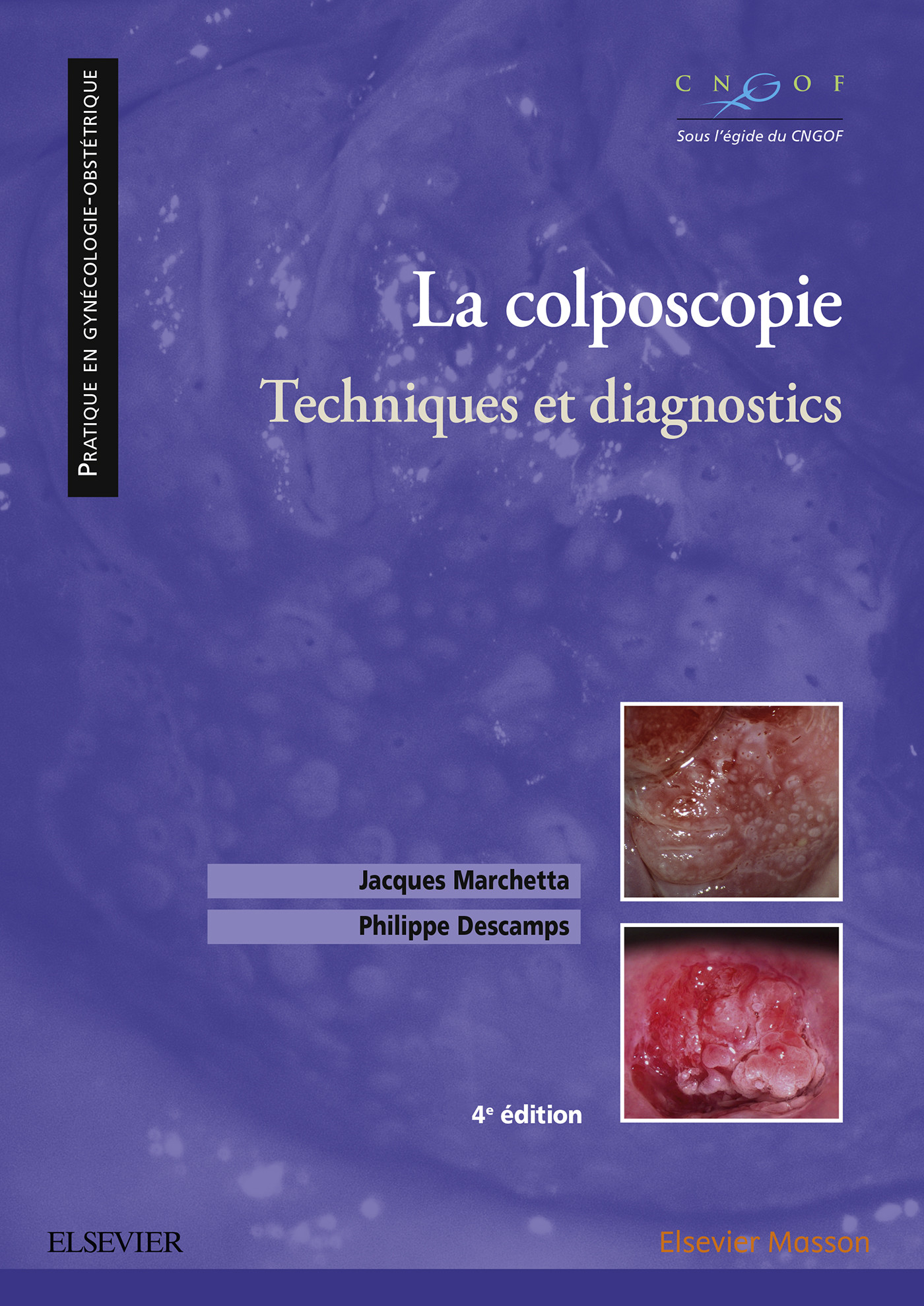 Cover La colposcopie