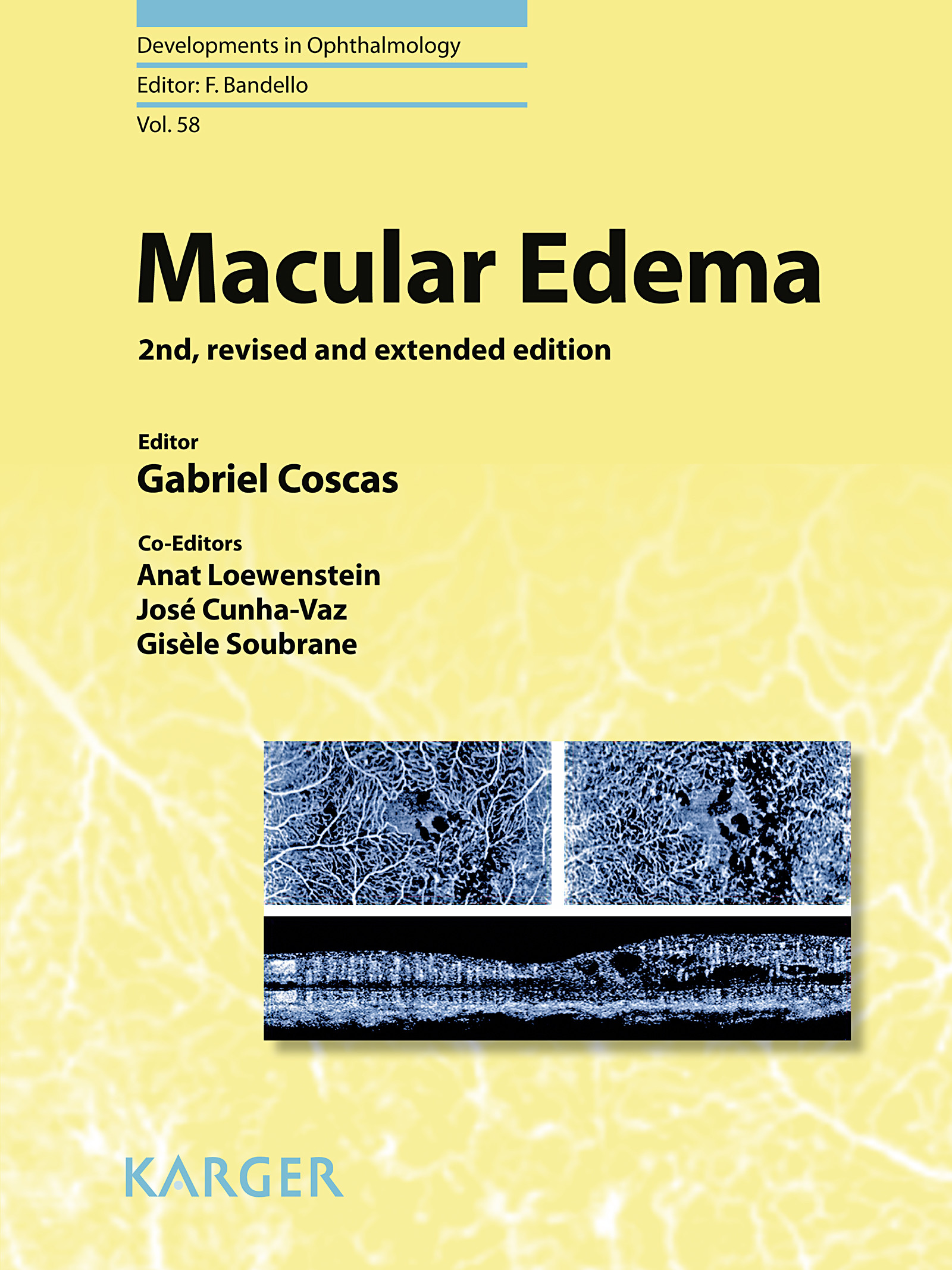 Cover Macular Edema