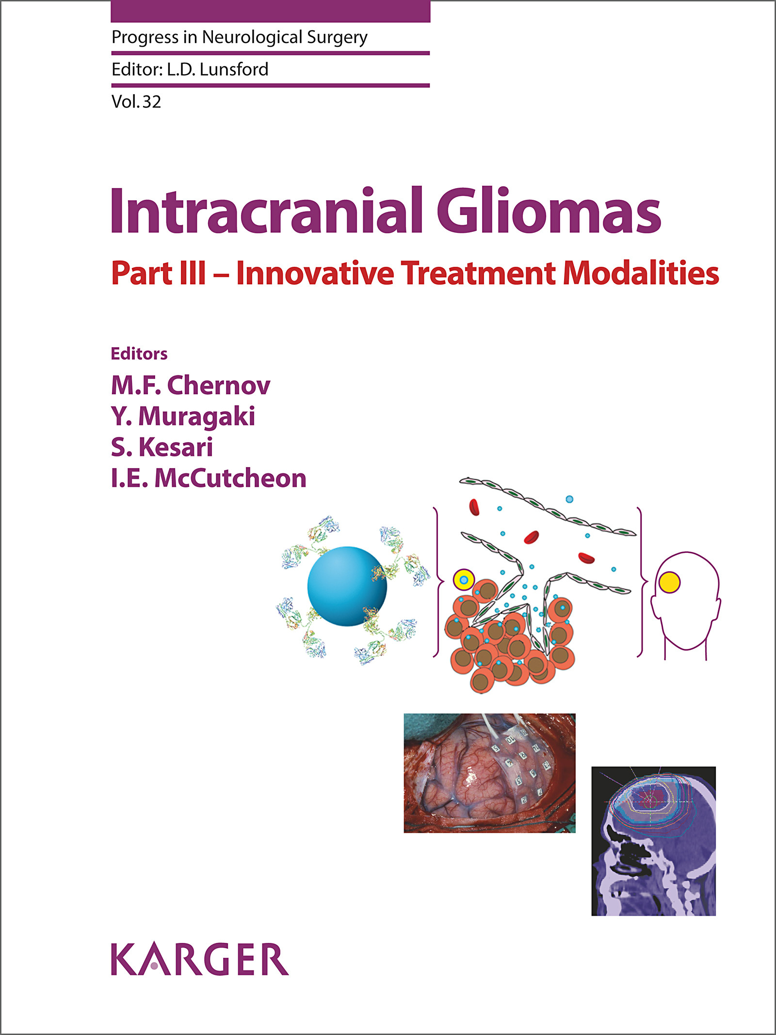Cover Intracranial Gliomas Part III - Innovative Treatment Modalities