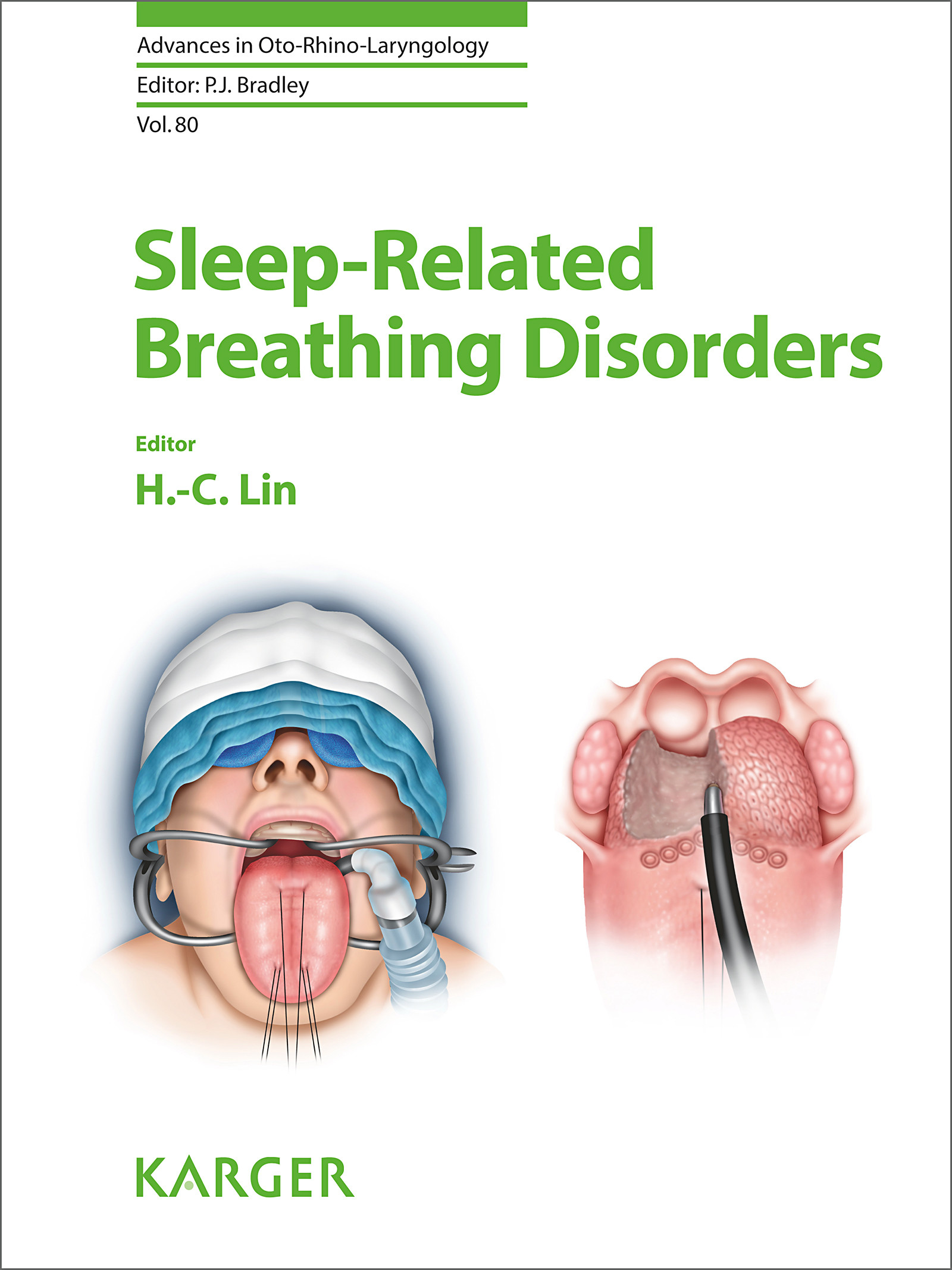 Cover Sleep-Related Breathing Disorders