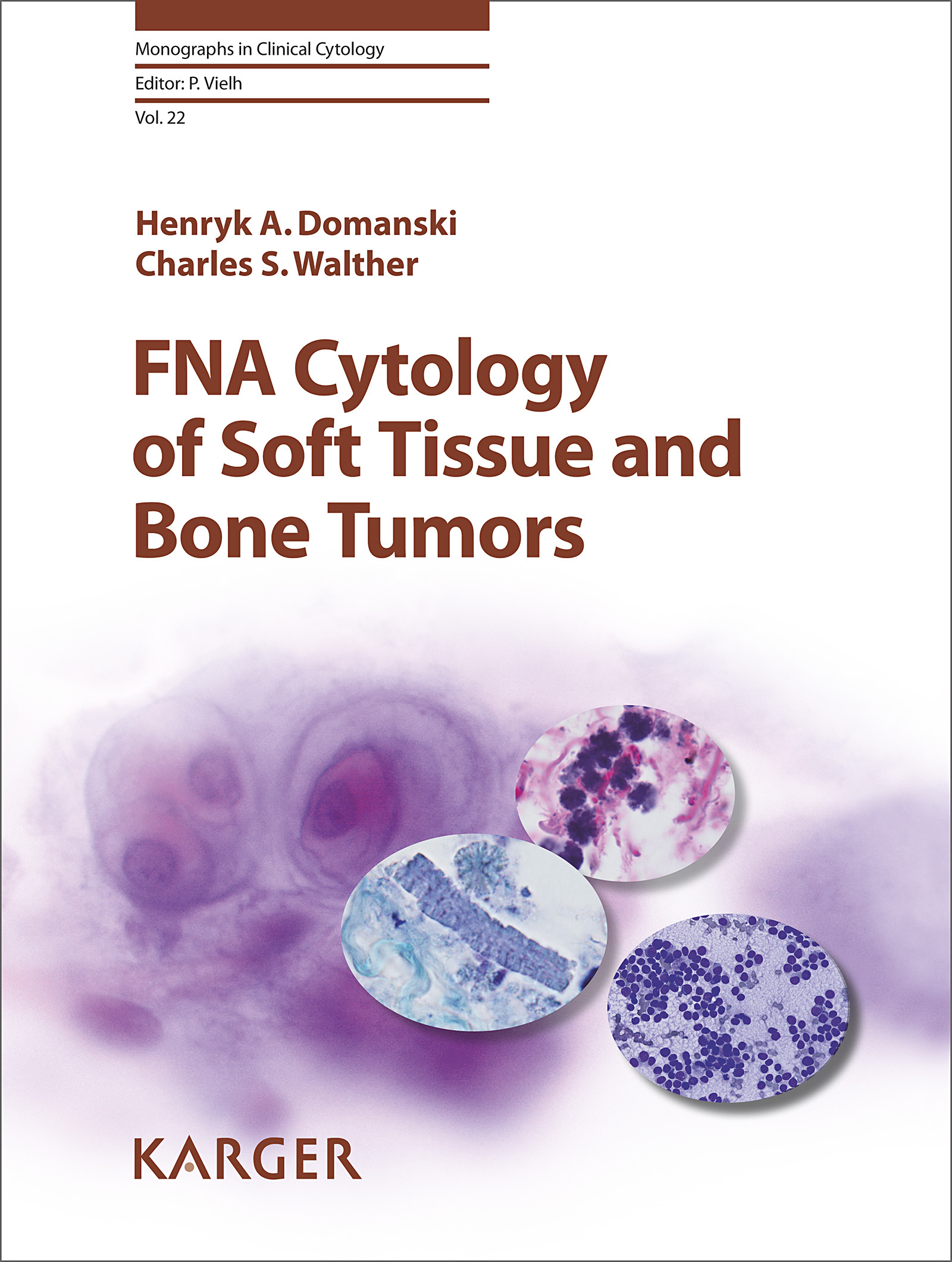 Cover FNA Cytology of Soft Tissue and Bone Tumors