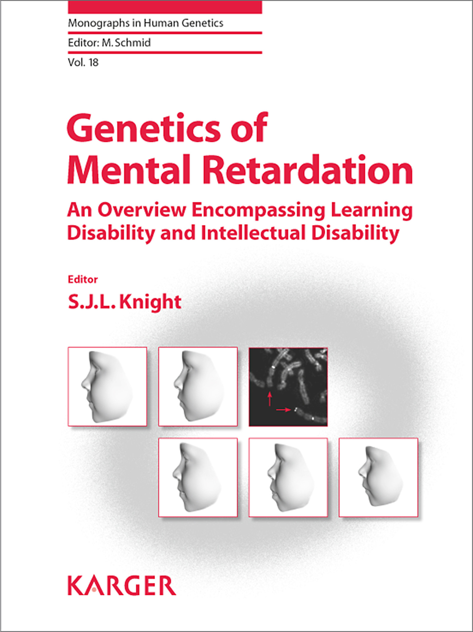 Cover Genetics of Mental Retardation
