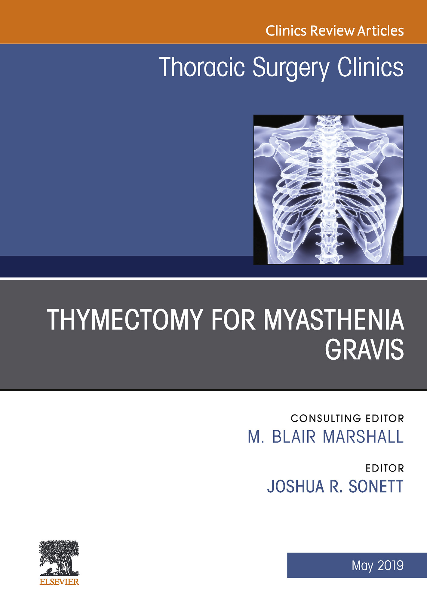 Thymectomy in Myasthenia Gravis, An Issue of Thoracic Surgery Clinics, Ebook