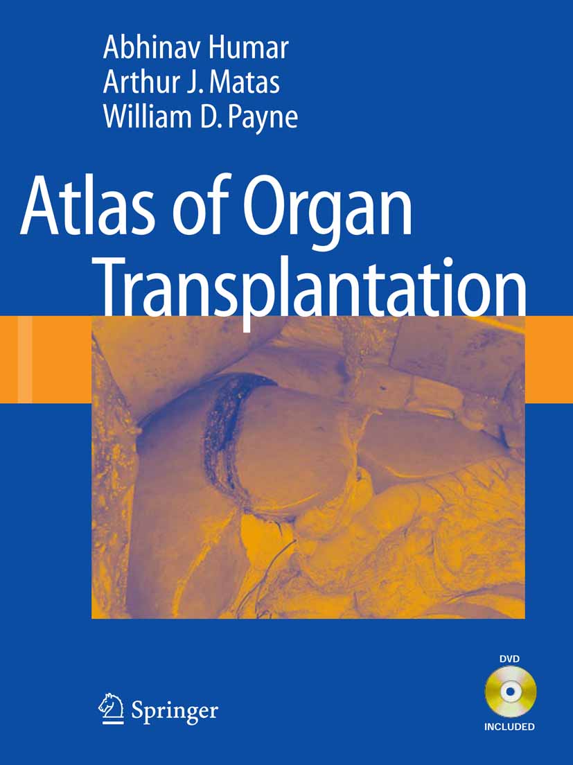 Atlas of Organ Transplantation