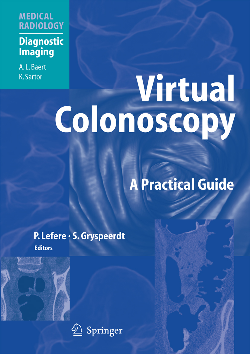 Cover Virtual Colonoscopy