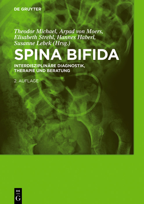 Cover Spina bifida