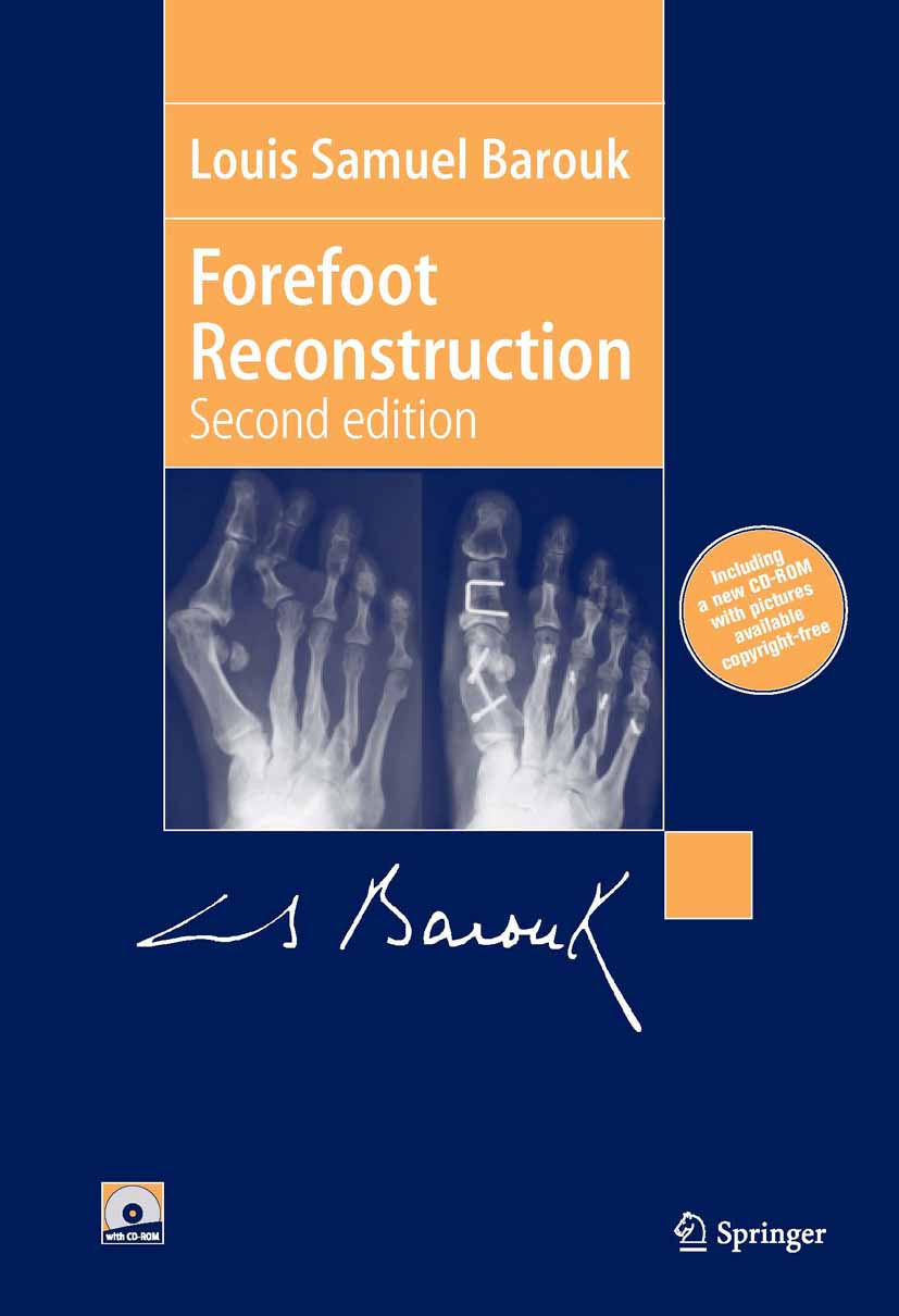 Cover Forefoot Reconstruction