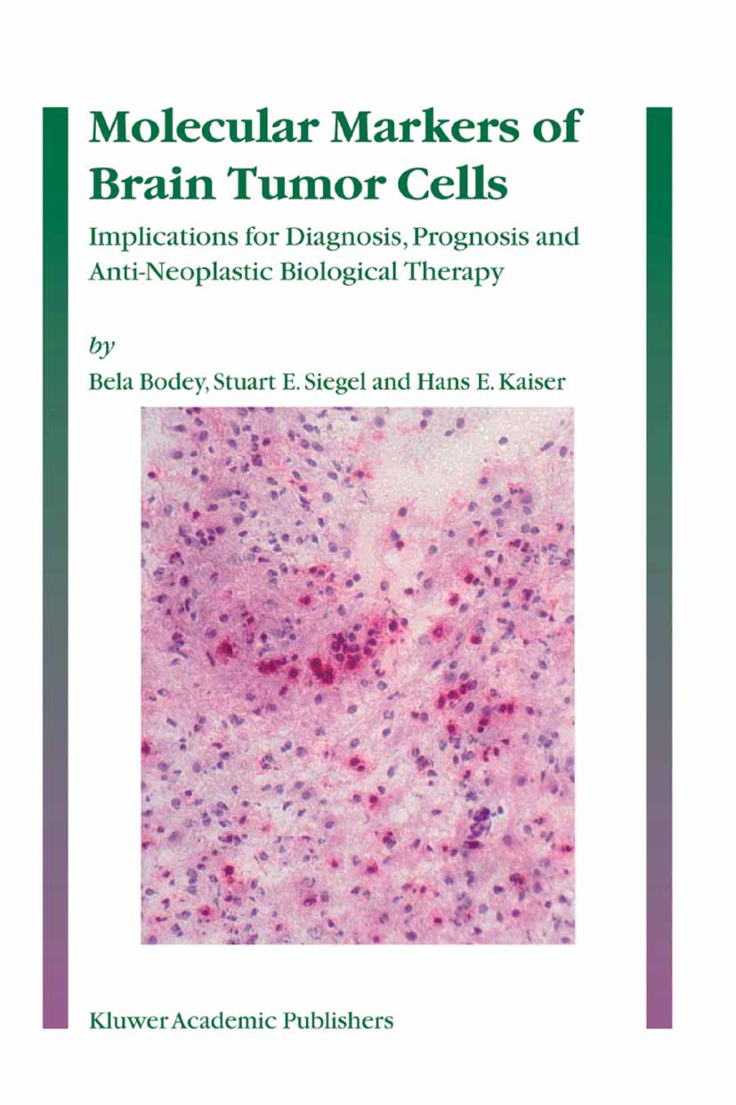 Cover Molecular Markers of Brain Tumor Cells