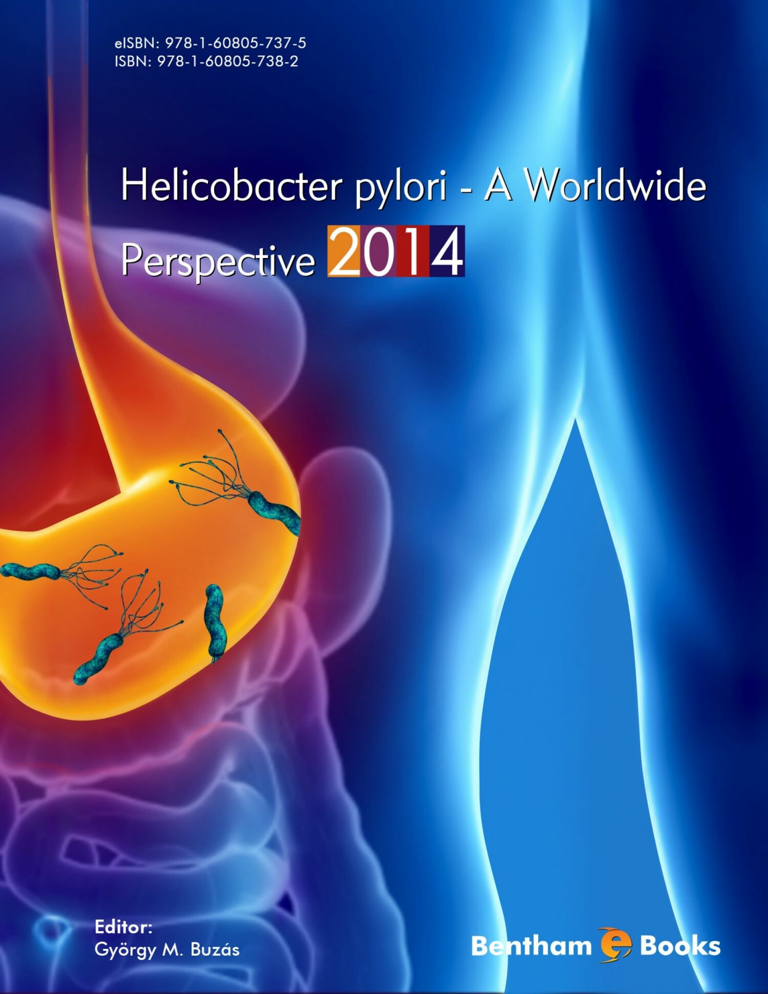 Cover Helicobacter pylori - A Worldwide Perspective 2014