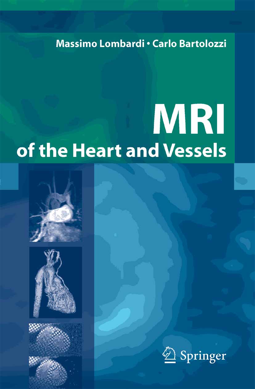 Cover MRI of the Heart and Vessels